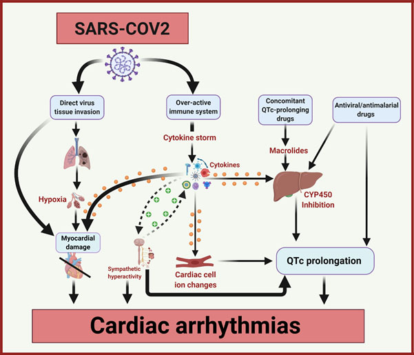Mechanisms of cardiac arrhythmias in COVID-19